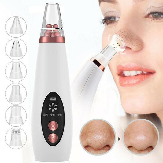 Blackhead Remover Vacuum Cleaner